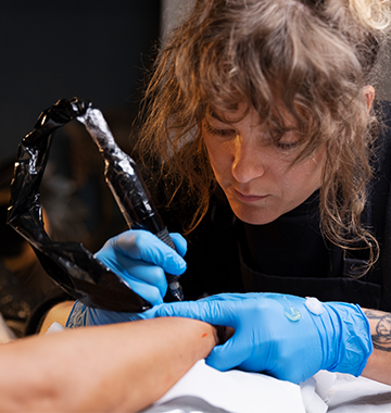 Everything You Need to Know About Tattoo Removal Treatment 